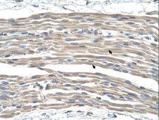 GPR161 Antibody - GPR161 antibody ARP42354_P050-NP_031395-GPR161(G protein-coupled receptor 161) Antibody was used in IHC to stain formalin-fixed, paraffin-embedded human muscle.  This image was taken for the unconjugated form of this product. Other forms have not been tested.
