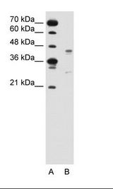 GPR161 Antibody - A: Marker, B: Jurkat Cell Lysate.  This image was taken for the unconjugated form of this product. Other forms have not been tested.