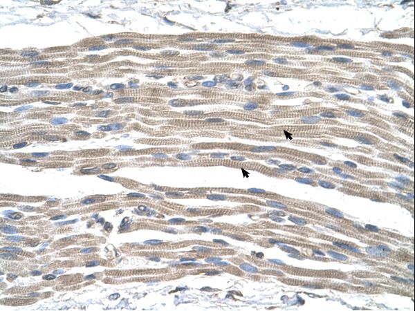 GPR161 Antibody - GPR161 antibody ARP42354_P050-NP_031395-GPR161(G protein-coupled receptor 161) Antibody was used in IHC to stain formalin-fixed, paraffin-embedded human muscle.  This image was taken for the unconjugated form of this product. Other forms have not been tested.