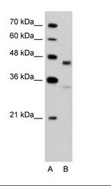 GPR161 Antibody - A: Marker, B: Jurkat Cell Lysate.  This image was taken for the unconjugated form of this product. Other forms have not been tested.