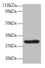 GPR161 Antibody - Western blot All lanes: 60S ribosomal protein L17 ntibody at 2µg/ml + EC109whole cell lysate Secondary Goat polyclonal to rabbit IgG at 1/15000 dilution Predicted band size: 59, 46, 44, 50, 47, 61 kDa Observed band size: 30 kDa