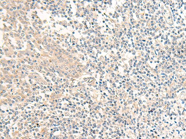 GPR161 Antibody - Immunohistochemistry of paraffin-embedded Human tonsil tissue  using GPR161 Polyclonal Antibody at dilution of 1:40(×200)