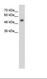 GPR161 Antibody - HepG2 Cell Lysate.  This image was taken for the unconjugated form of this product. Other forms have not been tested.