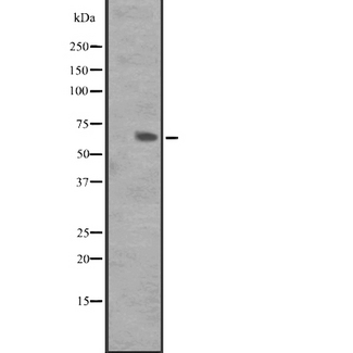 GPR162 Antibody - Western blot analysis of GPR162 expression in A431 whole cells lysate. The lane on the left is treated with the antigen-specific peptide.