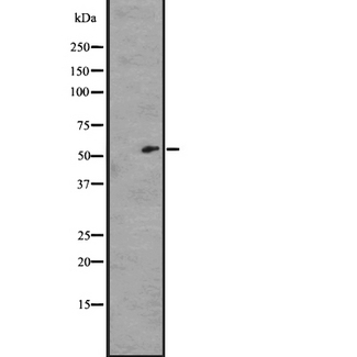 GPR162 Antibody - Western blot analysis of GPR162 antibody expression in A431 cells lysates. The lane on the left is treated with the antigen-specific peptide.