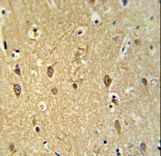 GPR17 Antibody - GPR17 Antibody IHC of formalin-fixed and paraffin-embedded brain tissue followed by peroxidase-conjugated secondary antibody and DAB staining.