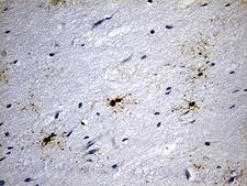 GPR17 Antibody - Immunohistochemical staining of paraffin-embedded Human adult brain tissue within the normal limits using anti-GPR17 mouse monoclonal antibody. (Heat-induced epitope retrieval by 1mM EDTA in 10mM Tris buffer. (pH8.5) at 120 oC for 3 min. (1:300)