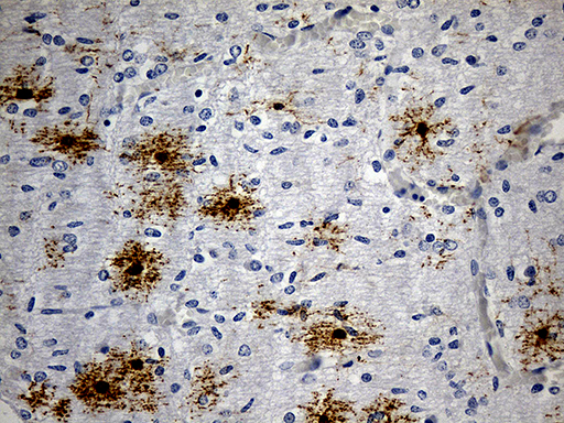 GPR17 Antibody - Immunohistochemical staining of paraffin-embedded Human embryonic cerebellum within the normal limits using anti-GPR17 mouse monoclonal antibody. (Heat-induced epitope retrieval by 1mM EDTA in 10mM Tris buffer. (pH8.5) at 120 oC for 3 min. (1:150)(1:300)