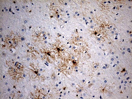 GPR17 Antibody - Immunohistochemical staining of paraffin-embedded rat cerebrum tissue within the normal limits using anti-GPR17 mouse monoclonal antibody. (Heat-induced epitope retrieval by 1mM EDTA in 10mM Tris buffer. (pH8.5) at 120 oC for 3 min. (1:200)