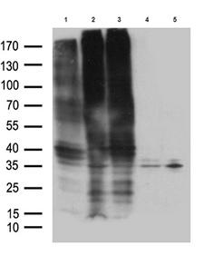 GPR17 Antibody - Western blot analysis of lysates from 293T cells transfected with. (1)pcDNA3.1-mGPR17. (2)pcDNA3.1-rGPR17. (3)pCINEO-hGPR17. (4)pcDNA3.1. (5)PCINEO plasmids using anti-GPR17 Mouse monoclonal antibody.