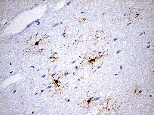 GPR17 Antibody - Immunohistochemical staining of paraffin-embedded Human adult brain tissue within the normal limits using anti-GPR17 mouse monoclonal antibody. (Heat-induced epitope retrieval by 1mM EDTA in 10mM Tris buffer. (pH8.5) at 120 oC for 3 min. (1:600)