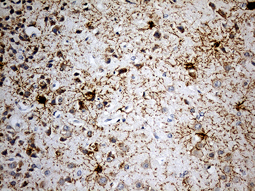GPR17 Antibody - Immunohistochemical staining of paraffin-embedded mouse cerebrum tissue within the normal limits using anti-GPR17 mouse monoclonal antibody. (Heat-induced epitope retrieval by 1mM EDTA in 10mM Tris buffer. (pH8.5) at 120 oC for 3 min. (1:200)