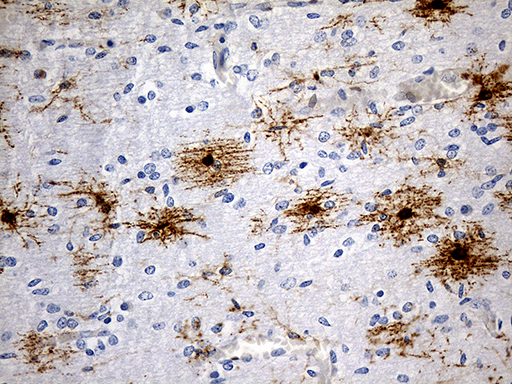 GPR17 Antibody - Immunohistochemical staining of paraffin-embedded Human embryonic cerebellum within the normal limits using anti-GPR17 mouse monoclonal antibody. (Heat-induced epitope retrieval by 1mM EDTA in 10mM Tris buffer. (pH8.5) at 120°C for 3 min. (1:600)