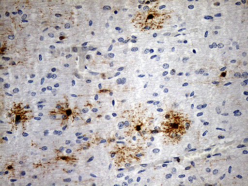 GPR17 Antibody - Immunohistochemical staining of paraffin-embedded Human embryonic cerebellum within the normal limits using anti-GPR17 mouse monoclonal antibody. (Heat-induced epitope retrieval by 1mM EDTA in 10mM Tris buffer. (pH8.5) at 120°C for 3 min. (1:100)