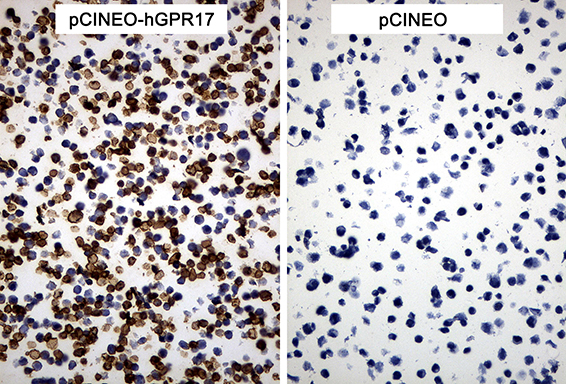 GPR17 Antibody - Immunohistochemical staining of paraffin-embedded cell pellets of 293T cells transfected with pCINEO-hGPR17 or pCINEO plasmids using anti-GPR17 Mouse monoclonal antibody. (Heat-induced epitope retrieval by Tris-EDTA buffer. (pH8.0) at 120°C for 2.5 min). (1:150)