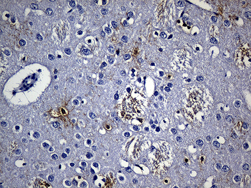 GPR17 Antibody - Immunohistochemical staining of paraffin-embedded rat cerebrum tissue within the normal limits using anti-GPR17 mouse monoclonal antibody. (Heat-induced epitope retrieval by 1mM EDTA in 10mM Tris buffer. (pH8.5) at 120 oC for 3 min. (1:150)