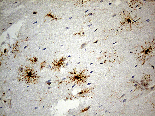 GPR17 Antibody - Immunohistochemical staining of paraffin-embedded Human adult brain tissue within the normal limits using anti-GPR17 mouse monoclonal antibody. (Heat-induced epitope retrieval by 1mM EDTA in 10mM Tris buffer. (pH8.5) at 120 oC for 3 min. (1:300)