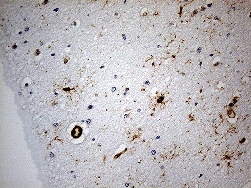 GPR17 Antibody - Immunohistochemical staining of paraffin-embedded Human embryonic brain cortex tissue within the normal limits using anti-GPR17 mouse monoclonal antibody. (Heat-induced epitope retrieval by 1mM EDTA in 10mM Tris buffer. (pH8.5) at 120 oC for 3 min. (1:300)