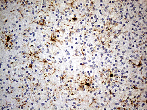 GPR17 Antibody - Immunohistochemical staining of paraffin-embedded Human embryonic cerebellum within the normal limits using anti-GPR17 mouse monoclonal antibody. (Heat-induced epitope retrieval by 1mM EDTA in 10mM Tris buffer. (pH8.5) at 120°C for 3 min. (1:300)