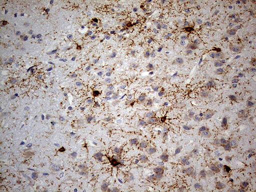 GPR17 Antibody - Immunohistochemical staining of paraffin-embedded mouse cerebrum tissue within the normal limits using anti-GPR17 mouse monoclonal antibody. (Heat-induced epitope retrieval by 1mM EDTA in 10mM Tris buffer. (pH8.5) at 120 oC for 3 min. (1:300)