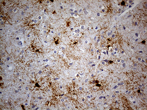 GPR17 Antibody - Immunohistochemical staining of paraffin-embedded rat cerebrum tissue within the normal limits using anti-GPR17 mouse monoclonal antibody. (Heat-induced epitope retrieval by 1mM EDTA in 10mM Tris buffer. (pH8.5) at 120 oC for 3 min. (1:300)