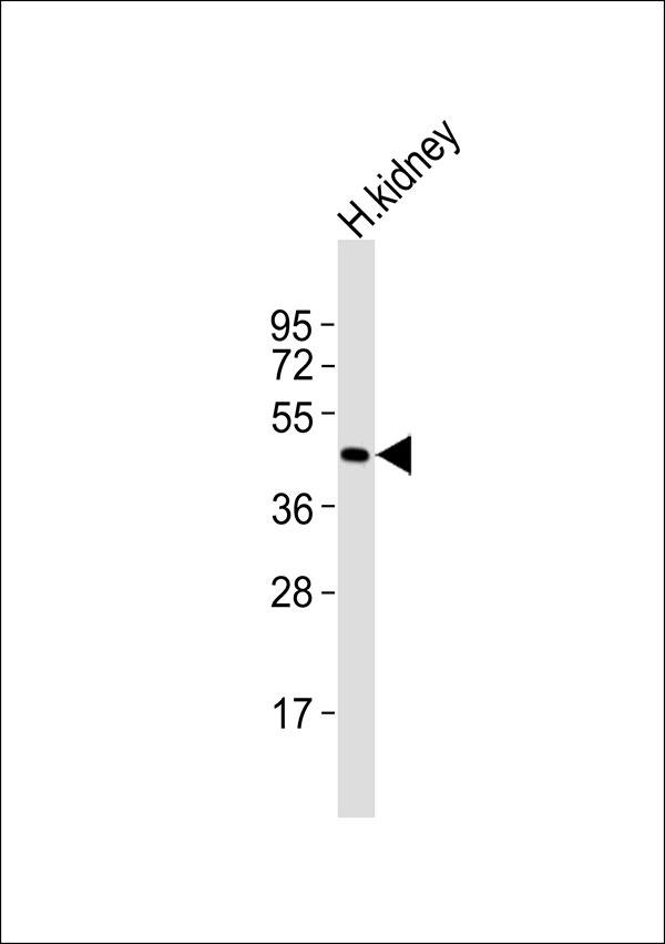 GPR17 Antibody - Anti-GPR17 Antibody at 1:1000 dilution + human kidney lysates Lysates/proteins at 20 ug per lane. Secondary Goat Anti-Rabbit IgG, (H+L),Peroxidase conjugated at 1/10000 dilution Predicted band size : 41 kDa Blocking/Dilution buffer: 5% NFDM/TBST.