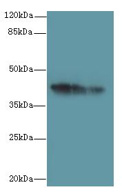 GPR17 Antibody - Western blot. All lanes: GPR17 antibody at 10 ug/ml. Lane 1: Mouse brain tissue. Lane 2: Human high value serum. Secondary antibody: Goat polyclonal to Rabbit IgG at 1:10000 dilution. Predicted band size: 41 kDa. Observed band size: 41 kDa.