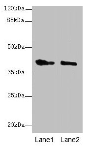 GPR17 Antibody - Western blot All lanes: GPR17 antibody at 10µg/ml Lane 1: Mouse brain tissue Lane 2: Human high value serumSecondary Goat polyclonal to rabbit IgG at 1/10000 dilution Predicted band size: 41, 38 kDa Observed band size: 41 kDa