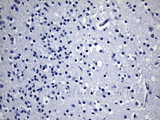 GPR17 Antibody - Immunohistochemical staining of paraffin-embedded Human adult brain tissue within the normal limits using anti-GPR17 mouse monoclonal antibody. This figure shows negative staining. (Heat-induced epitope retrieval by 1mM EDTA in 10mM Tris buffer. (pH8.5) at 120 oC for 3 min. (1:150)