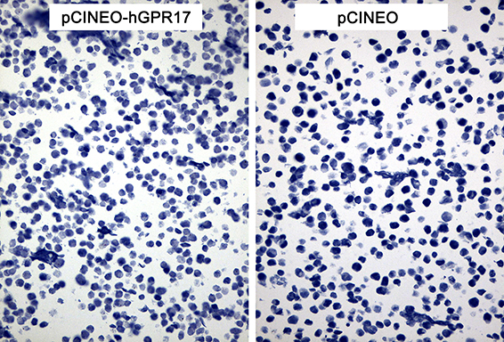 GPR17 Antibody - Immunohistochemical staining of paraffin-embedded cell pellets of 293T cells transfected with pCINEO-hGPR17 or pCINEO plasmids using anti-GPR17 Mouse monoclonal antibody. This figure shows negative staining. (Heat-induced epitope retrieval by Tris-EDTA buffer. (pH8.0) at 120°C for 2.5 min). (1:150)