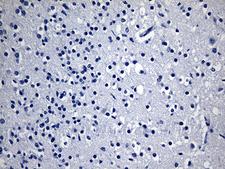 GPR17 Antibody - Immunohistochemical staining of paraffin-embedded Human adult brain tissue within the normal limits using anti-GPR17 mouse monoclonal antibody. This figure shows negative staining. (Heat-induced epitope retrieval by 1mM EDTA in 10mM Tris buffer. (pH8.5) at 120 oC for 3 min. (1:150)