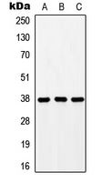 GPR171 Antibody - Western blot analysis of GPR171 expression in HEK293T (A); mouse liver (B); rat liver (C) whole cell lysates.