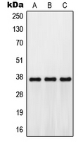 GPR171 Antibody - Western blot analysis of GPR171 expression in Jurkat (A); mouse kidney (B); H9C2 (C) whole cell lysates.