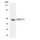 GPR173 / SREB3 Antibody - Western blot analysis of the lysates from HeLa cells using GPR173 antibody.