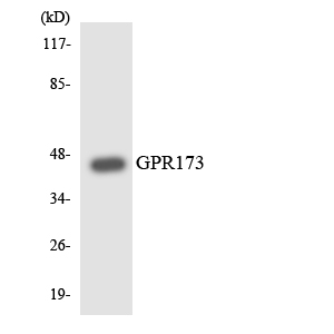 GPR173 / SREB3 Antibody - Western blot analysis of the lysates from COLO205 cells using GPR173 antibody.