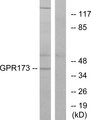 GPR173 / SREB3 Antibody - Western blot analysis of lysates from K562 cells, using GPR173 Antibody. The lane on the right is blocked with the synthesized peptide.