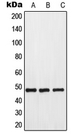 GPR173 / SREB3 Antibody - Western blot analysis of GPR173 expression in HeLa (A); mouse kidney (B); rat kidney (C) whole cell lysates.