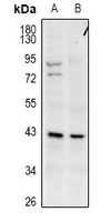 GPR173 / SREB3 Antibody - Western blot analysis of GPR173 expression in CT26 (A), C6 (B) whole cell lysates.