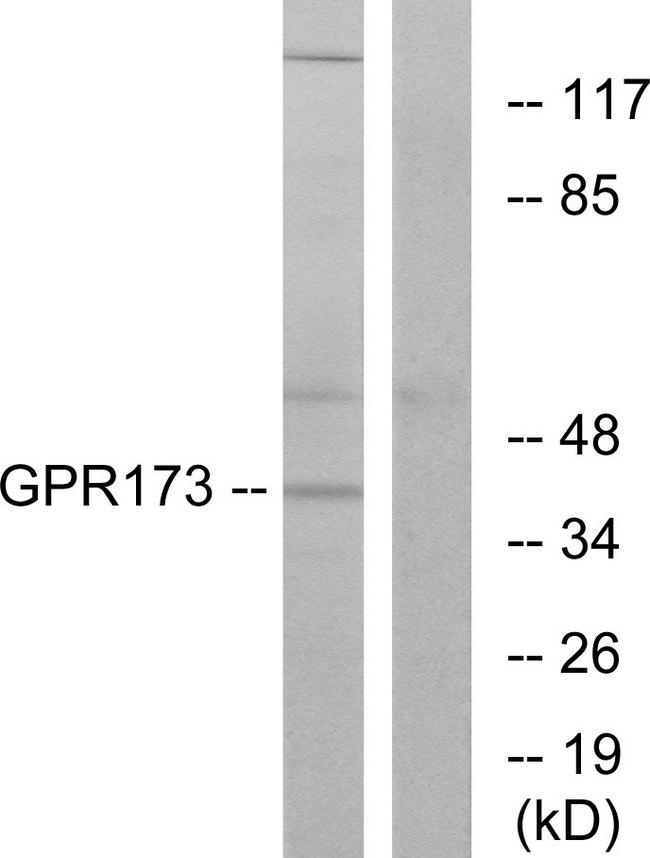 GPR173 / SREB3 Antibody - Western blot analysis of extracts from K562 cells, using GPR173 antibody.