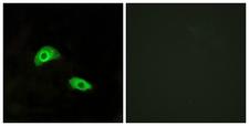 GPR174 Antibody - Immunofluorescence analysis of HeLa cells, using GPR174 Antibody. The picture on the right is blocked with the synthesized peptide.