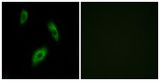 GPR174 Antibody - Immunofluorescence analysis of LOVO cells, using GPR174 Antibody. The picture on the right is blocked with the synthesized peptide.