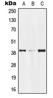 GPR174 Antibody - Western blot analysis of GPR174 expression in Jurkat (A); mouse kidney (B); rat kidney (C) whole cell lysates.