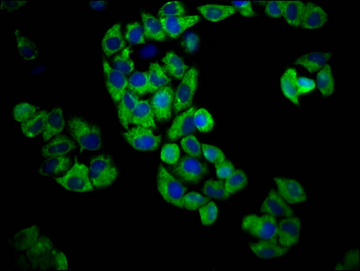 GPR174 Antibody - Immunofluorescence staining of Hela cells diluted at 1:100, counter-stained with DAPI. The cells were fixed in 4% formaldehyde, permeabilized using 0.2% Triton X-100 and blocked in 10% normal Goat Serum. The cells were then incubated with the antibody overnight at 4°C.The Secondary antibody was Alexa Fluor 488-congugated AffiniPure Goat Anti-Rabbit IgG (H+L).