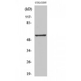 GPR176 Antibody - Western blot of GPR176 antibody