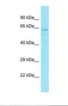 GPR176 Antibody - Western blot of PANC1 Whole Cell. HEATR8 antibody dilution 1.0 ug/ml.  This image was taken for the unconjugated form of this product. Other forms have not been tested.