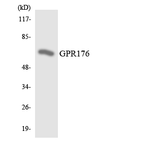 GPR176 Antibody - Western blot analysis of the lysates from HeLa cells using GPR176 antibody.