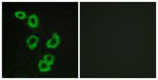 GPR176 Antibody - Immunofluorescence analysis of MCF7 cells, using GPR176 Antibody. The picture on the right is blocked with the synthesized peptide.
