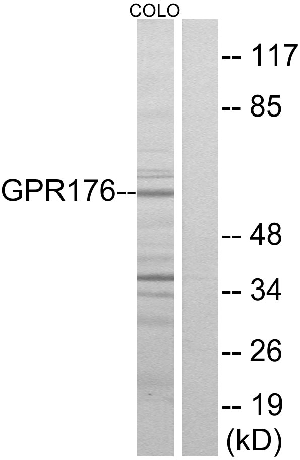 GPR176 Antibody - Western blot analysis of lysates from COLO205 cells, using GPR176 Antibody. The lane on the right is blocked with the synthesized peptide.