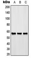 GPR176 Antibody - Western blot analysis of GPR176 expression in HeLa (A); SP2/0 (B); rat liver (C) whole cell lysates.