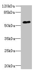 GPR176 Antibody - Western blot All lanes: GPR176 antibody at 10µg/ml + A431 whole cell lysate Secondary Goat polyclonal to rabbit IgG at 1/10000 dilution Predicted band size: 57 kDa Observed band size: 57 kDa